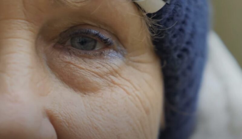 recovery of cataract surgery
